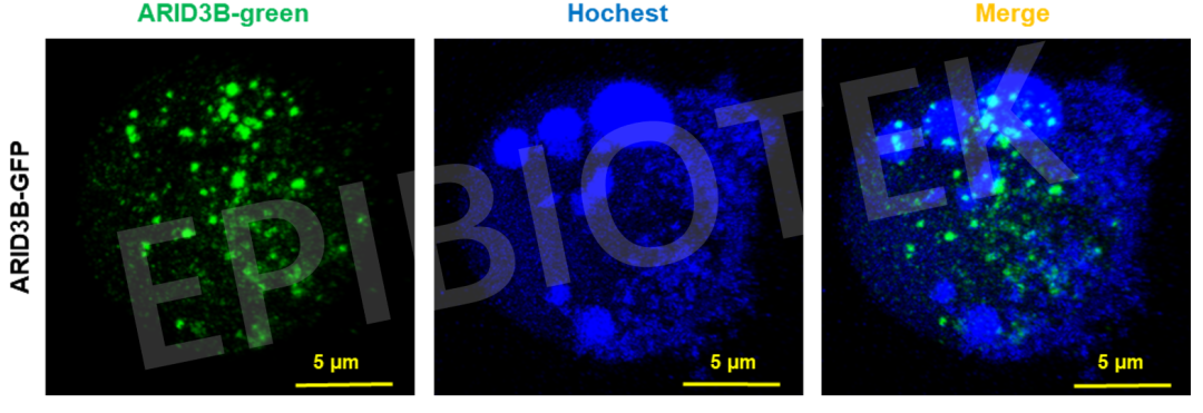 蛋白融合荧光细胞系构建以及活细胞成相实验