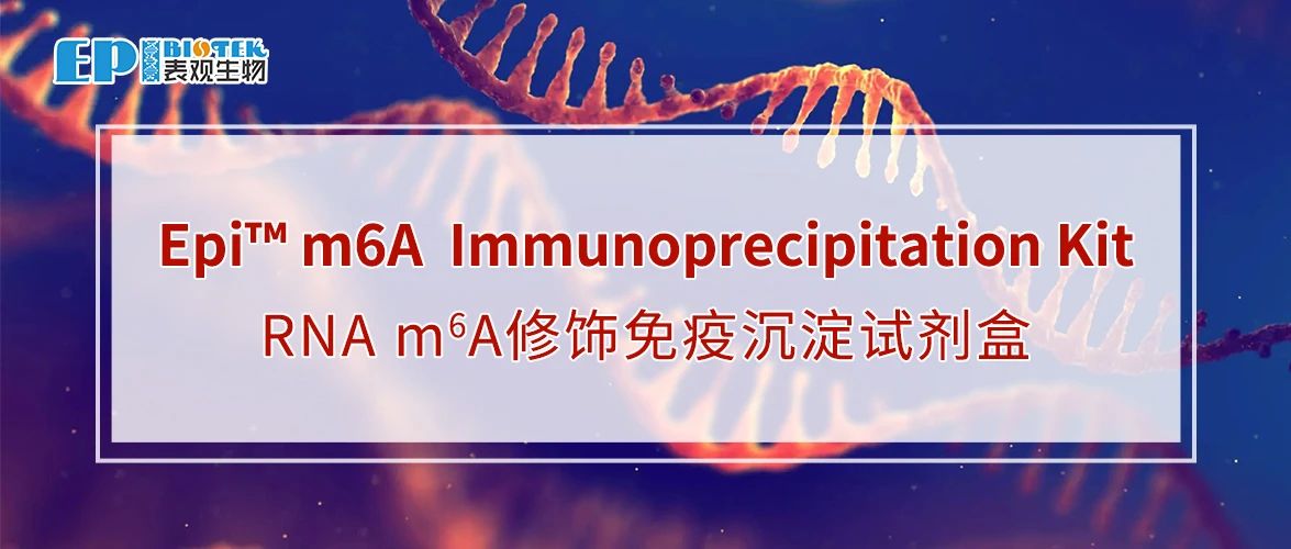 RNAm6A修饰免疫沉淀建库试剂盒：Epi™ m6A Immunoprecipitation Kit:图
