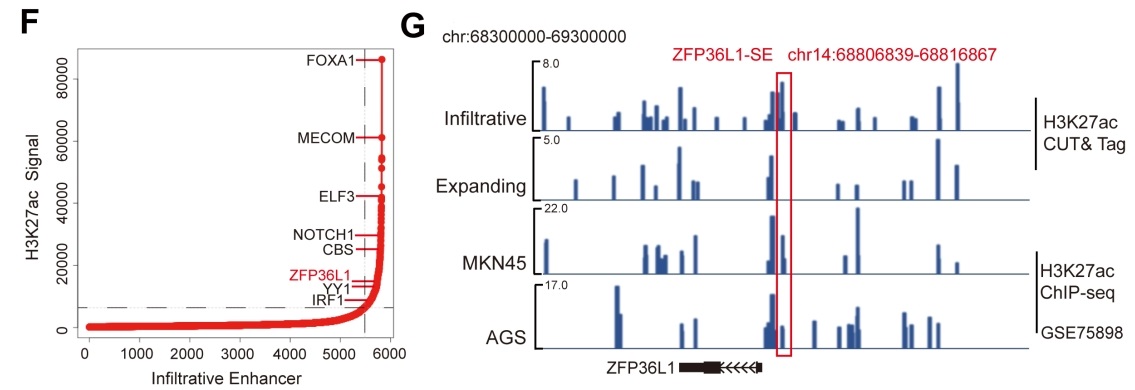 2. Elife：Super-enhancer-driven ZFP36L1 promotes PD-L1 expression in infiltrative gastric cancer[3]