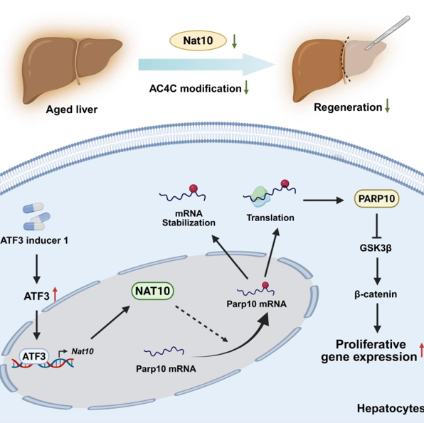 Clin Mol Hepatol（IF=21.7） | NAT10介导的ac4C修饰通过PARP10轴驱动老年肝再生图